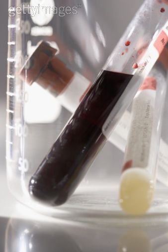 PA DUI blood tests